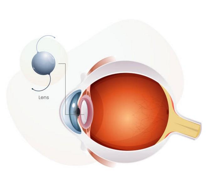 Conheça os tratamentos de doenças da retina