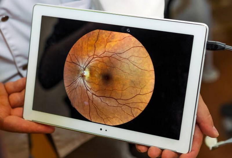 Importância da detecção ágil para tratamento de doenças da retinas