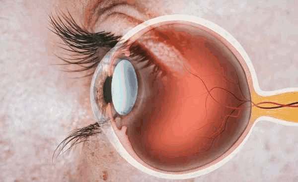 Clínica de comorbidade cirurgia de olhos